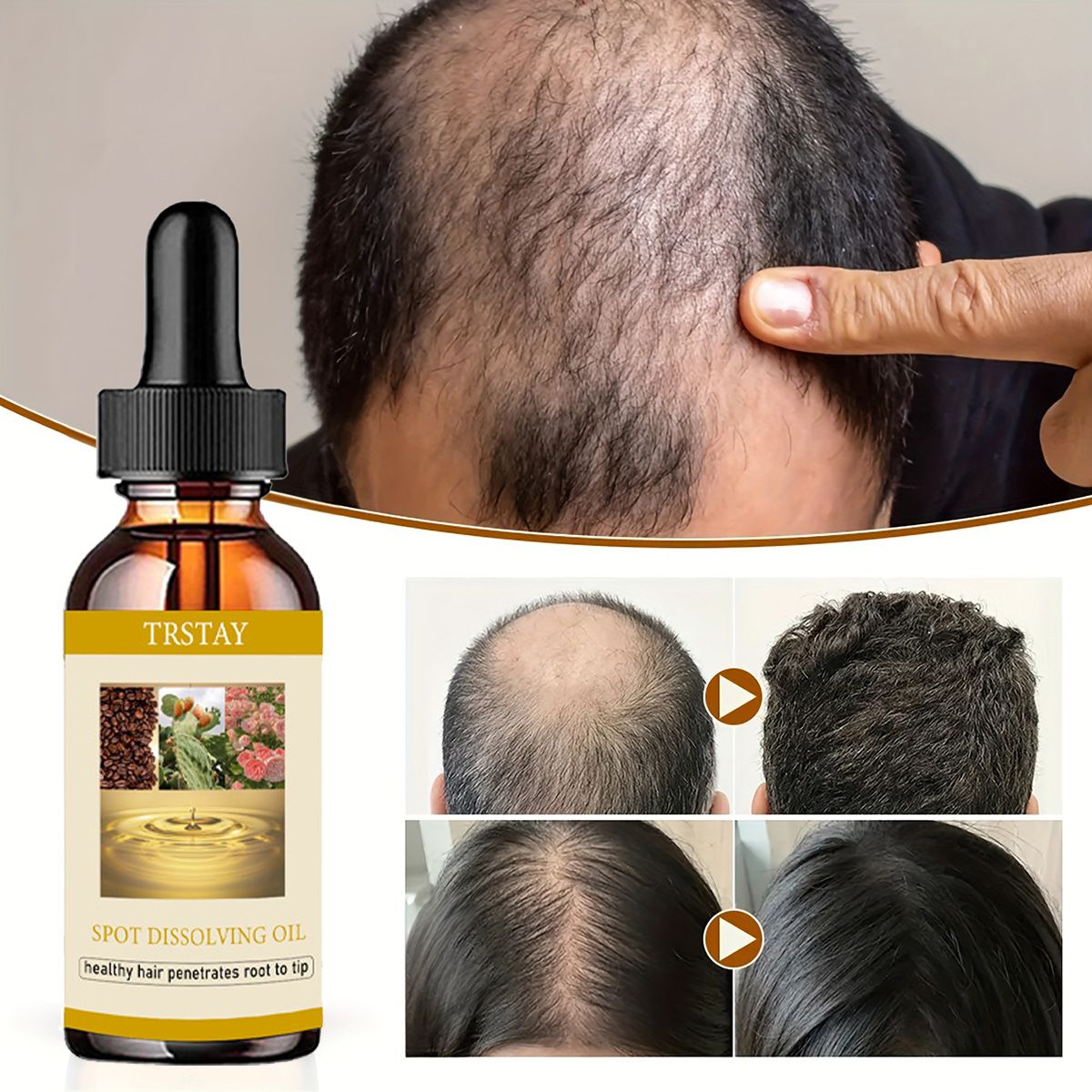 Beard Oil - 50ML Mọc Râu Tinh Dầu Chống